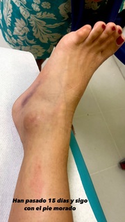 Carlota Boza feet photo 12