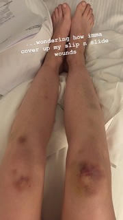 Carlson Young feet photo thumbnail