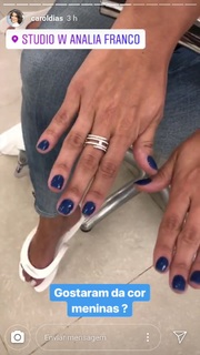 Carol Dias feet photo thumbnail