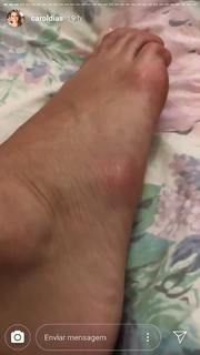 Carol Dias feet photo thumbnail