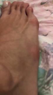 Carol Dias feet photo thumbnail