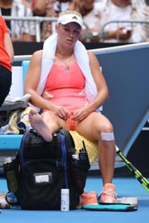 Caroline Wozniacki feet photo thumbnail