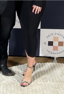 Casey Burgess feet photo 9