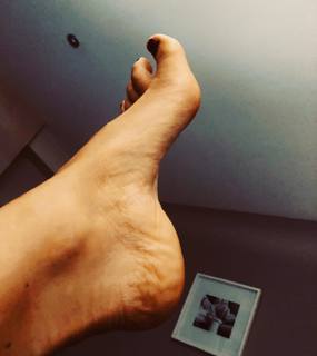 Catherine Tyldesley feet photo thumbnail