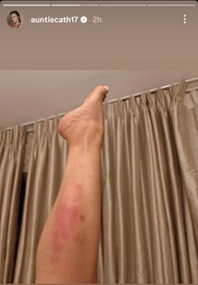 Catherine Tyldesley feet photo thumbnail