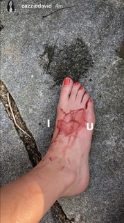 Cazzie David feet photo 19