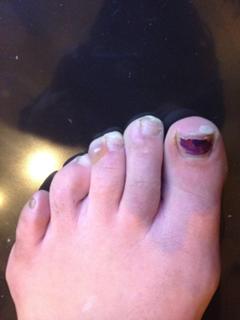 Charlie Webster feet photo 10