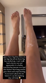 Chelsee Healey feet photo 4