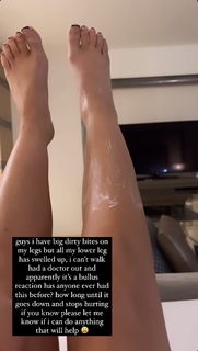 Chelsee Healey feet photo 3