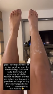 Chelsee Healey feet photo 2
