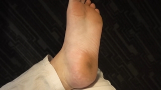 Cherrygumms feet photo 13