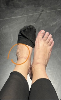 Cherrygumms feet photo 9