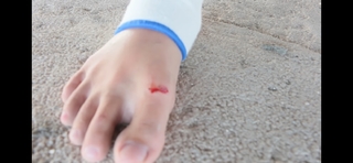 Chintya Candranaya feet photo thumbnail