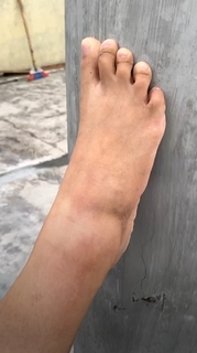 Chintya Candranaya feet photo thumbnail