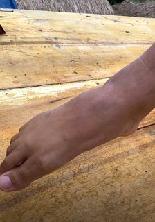 Chintya Candranaya feet photo thumbnail