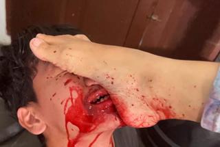 Chintya Candranaya feet photo thumbnail