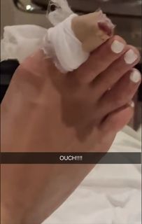Chloe Burrows feet photo thumbnail