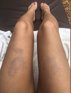 Chloe Meadows feet photo thumbnail