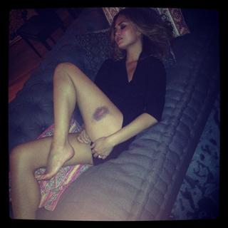 Chrissy Teigen feet photo thumbnail