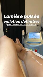 Clara Berry feet photo 18