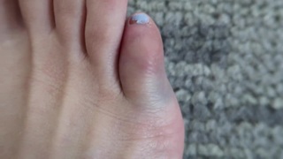 Colleen Ballinger feet photo thumbnail
