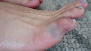 Colleen Ballinger feet photo thumbnail