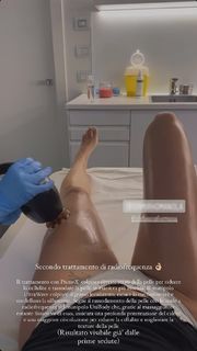 Cristina Buccino feet photo thumbnail