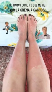 Dafne Fernández feet photo thumbnail
