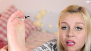 Dagi Bee feet photo thumbnail