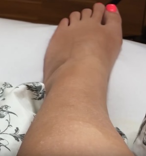 Dagi Bee feet photo thumbnail
