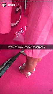 Dagi Bee feet photo thumbnail