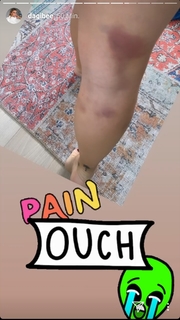 Dagi Bee feet photo thumbnail