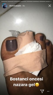 Demet Akalin feet photo thumbnail