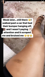 Demetria Obilor feet photo thumbnail