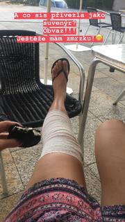 Denisa Pfauserová feet photo 8