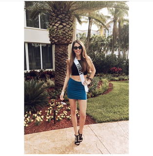 Dilan Çiçek Deniz feet photo thumbnail