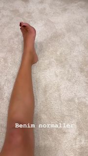 Dilek Kaya feet photo 1