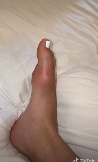 Dixie D'Amelio feet photo thumbnail