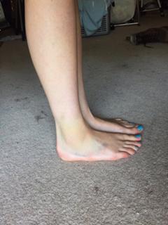 Dodie Clark feet photo thumbnail