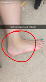 Dodie Clark feet photo thumbnail