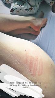 Dodie Clark feet photo thumbnail