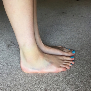 Dodie Clark feet photo thumbnail