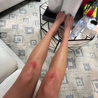 Dua Lipa feet photo thumbnail