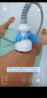 Dunja Jovanić feet photo 4