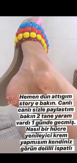 Ebru Polat feet photo 2