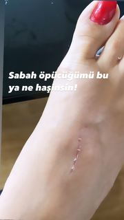 Ebru Polat feet photo 10
