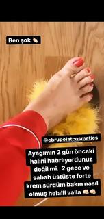 Ebru Polat feet photo 3