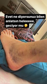 Ebru Polat feet photo 20