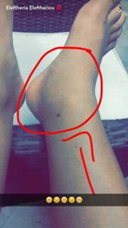 Eleftheria Eleftheriou feet photo thumbnail