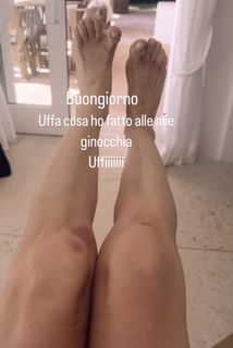 Elisabetta Franchi feet photo thumbnail